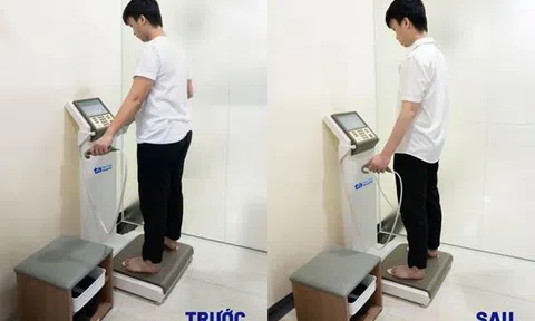 Giảm 22kg, chàng trai 23 tuổi lấy lại cuộc sống khỏe mạnh