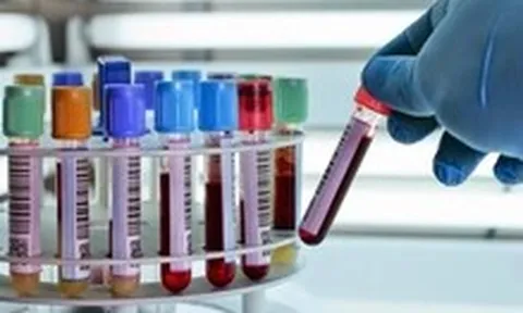 Bé trai 7 tuổi nhịn ăn gần 1 tháng vì 'viêm tụy cấp giả', bác sĩ bất ngờ tìm ra nguyên nhân