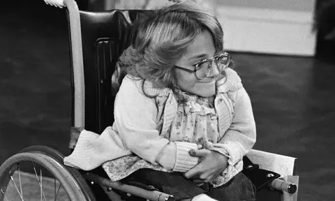 Diễn viên Melanie Watson mắc bệnh xương thủy tinh qua đời ở tuổi 57