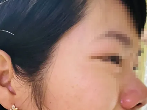 Bản tin 8H: Thầy giáo bị tố xông vào nhà hành hung cô giáo của con