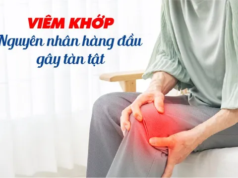 Viêm khớp - Nguyên nhân hàng đầu gây tàn tật