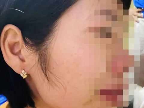 Vụ phụ huynh đánh cô giáo vì con hạnh kiểm trung bình: Xem xét kỷ luật