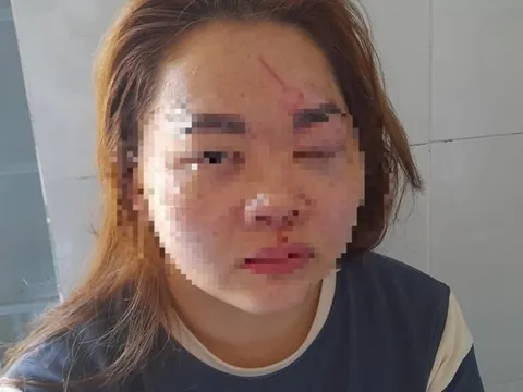 Tin mới vụ thầy giáo ở Đắk Lắk đánh vợ nhập viện cấp cứu