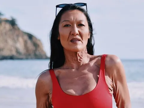 Người mẫu nội y 32 tuổi có làn da nhăn nheo như người già