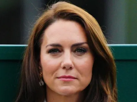 Lý do Công nương Kate đột ngột công bố mắc ung thư