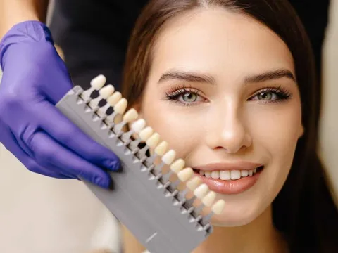 Giấm, kem đánh răng và muối có thể làm trắng răng sau 3-4 ngày không?