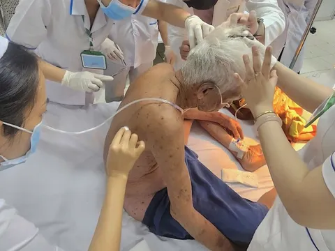 Người đàn ông 74 tuổi bị ong đốt hơn 100 vết đã tử vong