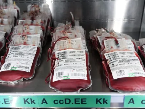 Nhóm máu liên quan đến nguy cơ mắc ung thư dạ dày